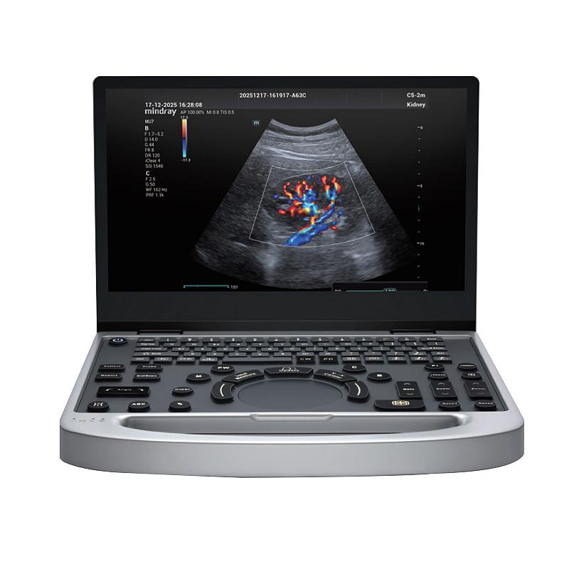 迈瑞 Mindray 便携式超声诊断设备MU7S粉钻（腹部C5-2m-e）