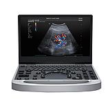 迈瑞 Mindray 便携式超声诊断设备MU7S蓝钻（腹部C5-2m-e+浅表L12-3m-e）