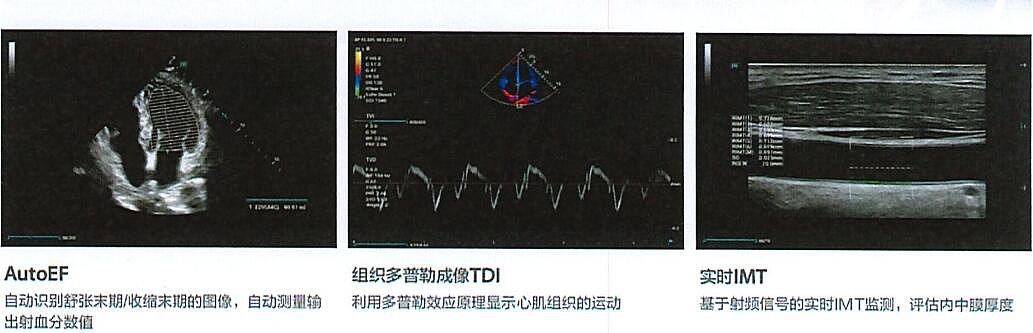 迈瑞 Mindray 彩色多普勒超声系统Consona AT（腔内标配）产品优势