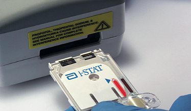 雅培 Abbott 手持式血液分析仪 i-STAT 300-G使用方法